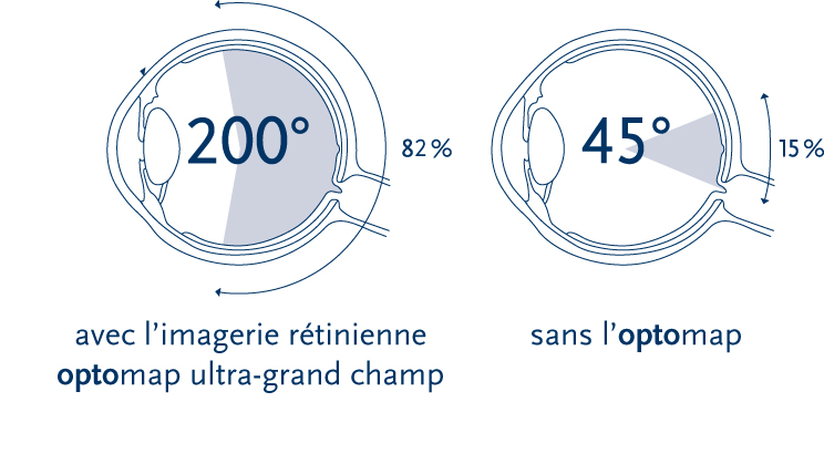 200 vs 45 degrees 200 vs 45 degrees
