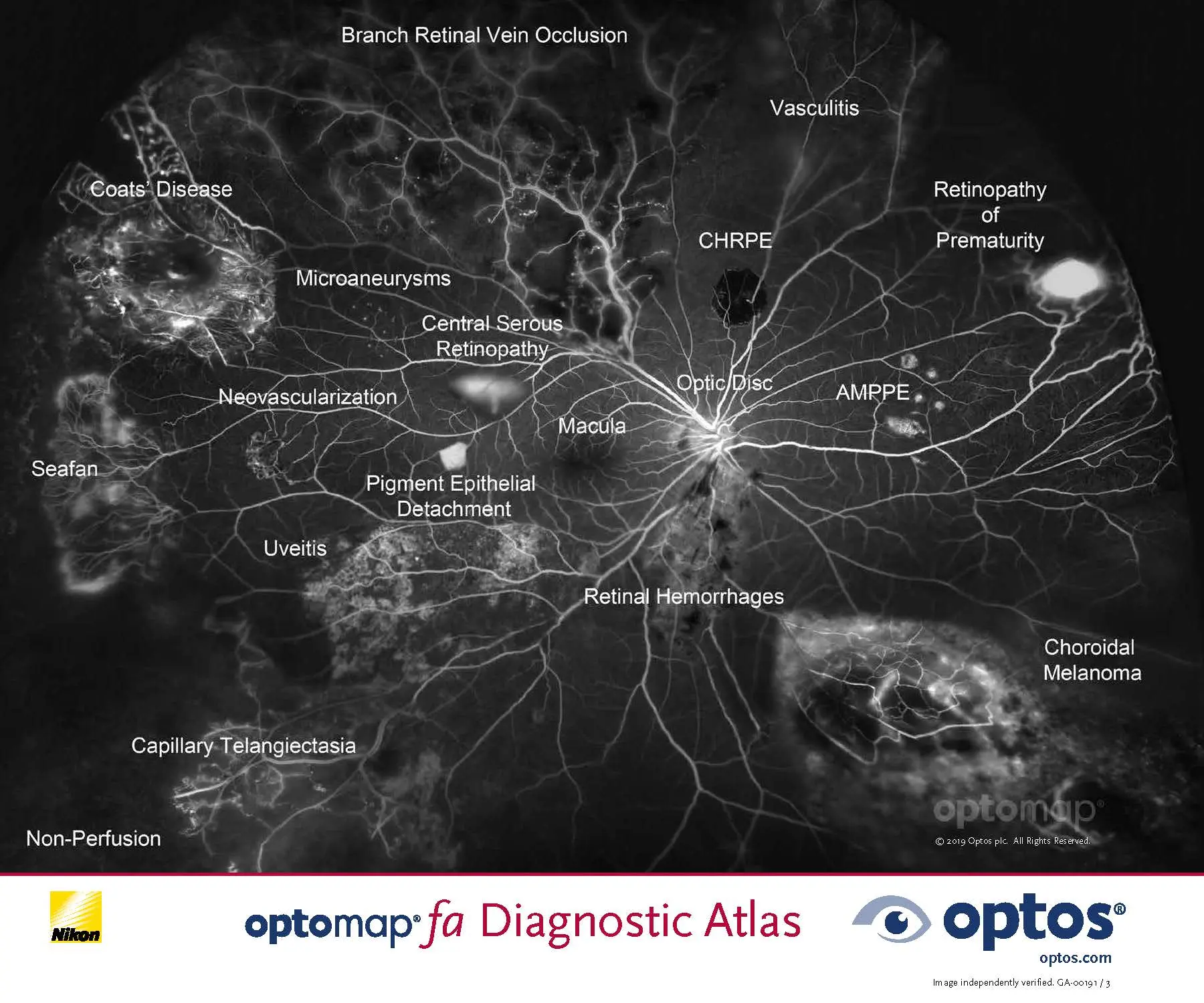 optomap fa diagnostic atlas