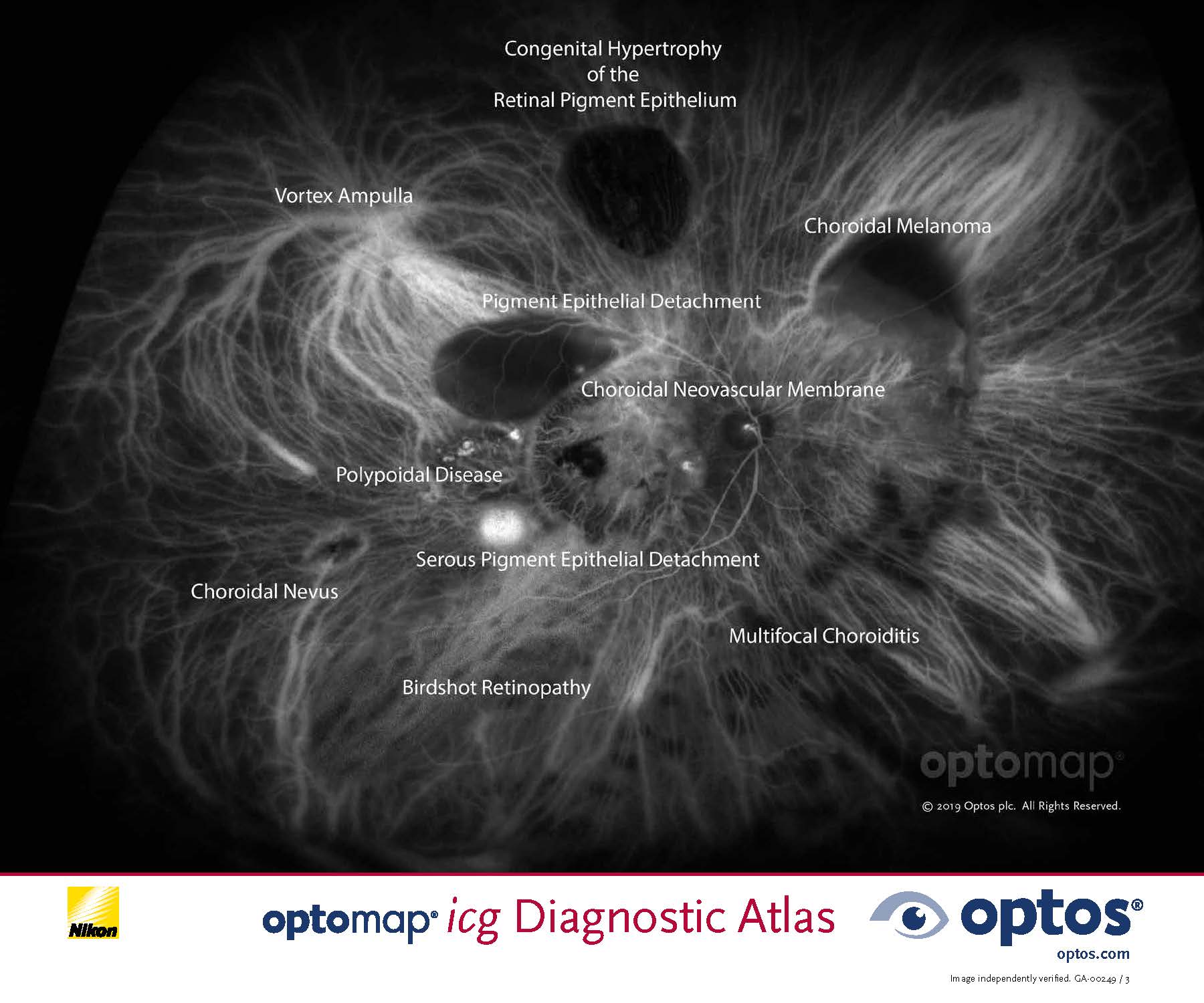 optomap icg diagnostic atlas